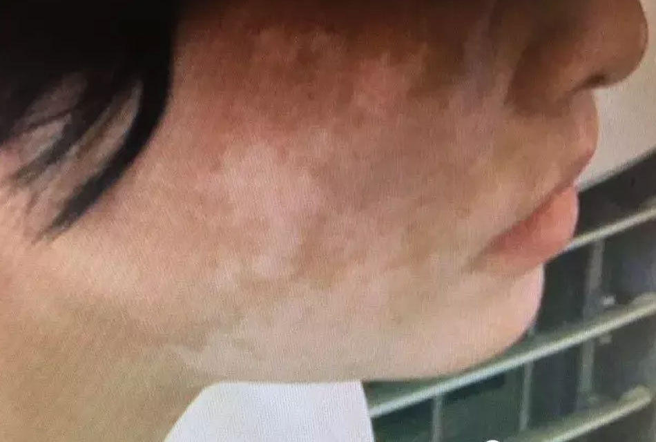 Chi hàng trăm triệu đồng để mua mỹ phẩm thần thánh không rõ nguồn gốc, người phụ nữ hứng chịu làn da loang lổ - Ảnh 3. Chi hàng trăm triệu đồng để mua mỹ phẩm thần thánh không rõ nguồn gốc, người phụ nữ hứng chịu làn da loang lổ - Ảnh 3.