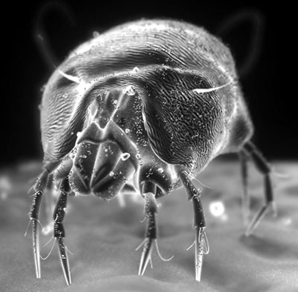 Điều kinh dị này chắc chắn sẽ xảy ra nếu bạn không chịu giặt ga trải giường - Ảnh 3. Điều kinh dị này chắc chắn sẽ xảy ra nếu bạn không chịu giặt ga trải giường - Ảnh 3.