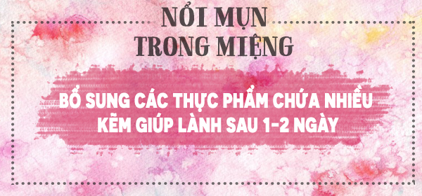 8 mẹo vặt “nhỏ mà có võ” giúp cuộc sống của bạn dễ dàng hơn - Ảnh 7.