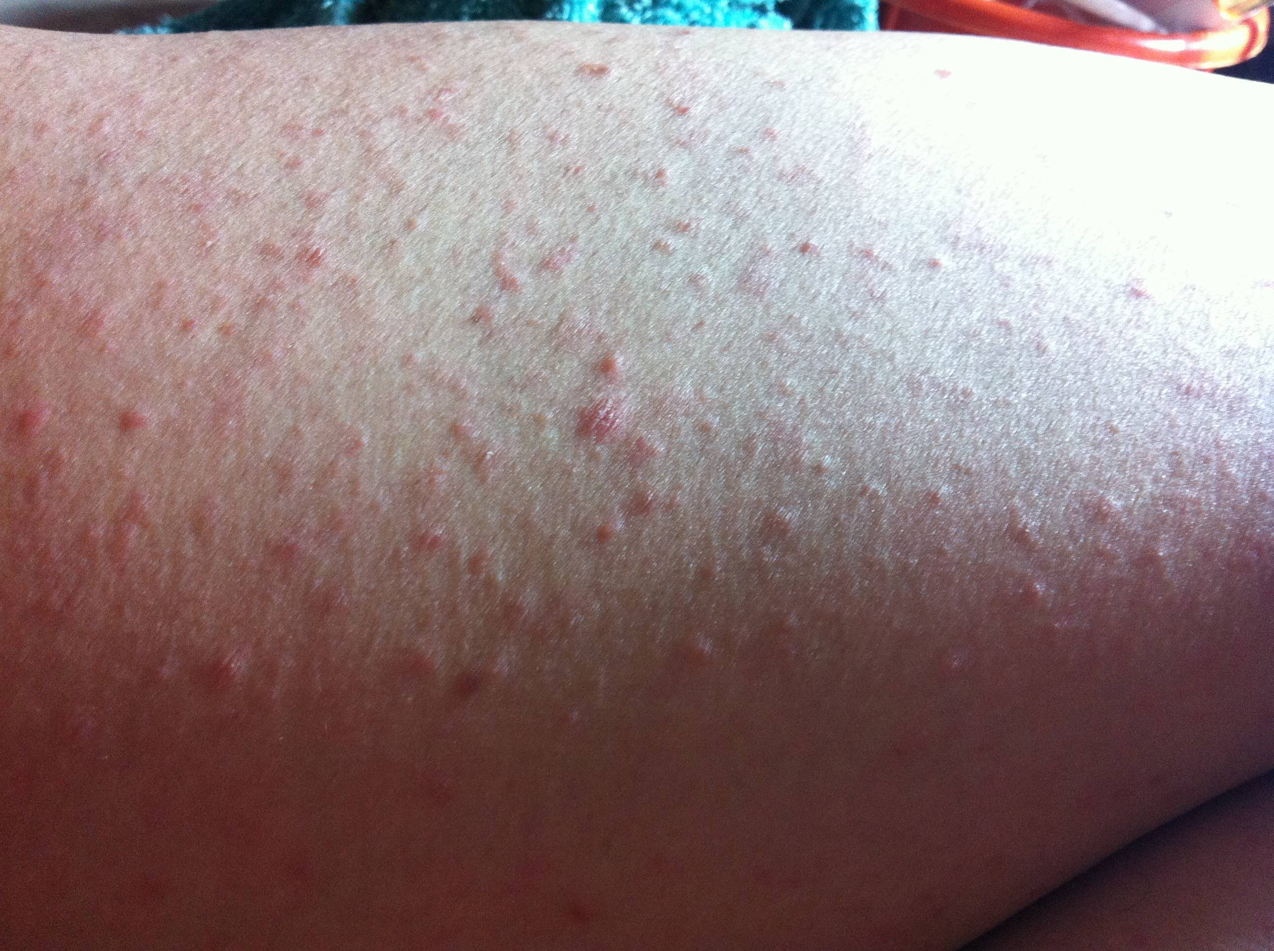 Loạt dấu hiệu cho thấy cơ thể bạn đang tích tụ quá nhiều độc tố - Ảnh 3. Loạt dấu hiệu cho thấy cơ thể bạn đang tích tụ quá nhiều độc tố - Ảnh 3.