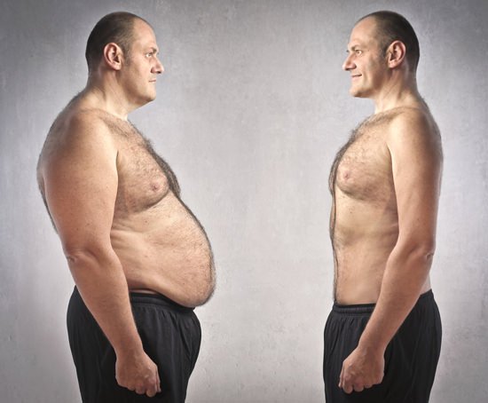 Một tác hại mới xuất hiện khiến người béo phì chỉ muốn giảm cân ngay lập tức - Ảnh 2.