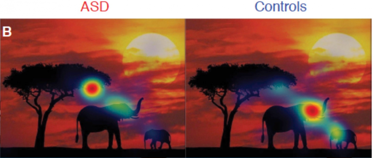 Bạn biết không, cách người tự kỷ nhìn thế giới cực kỳ khác - Ảnh 9. Bạn biết không, cách người tự kỷ nhìn thế giới cực kỳ khác - Ảnh 9.