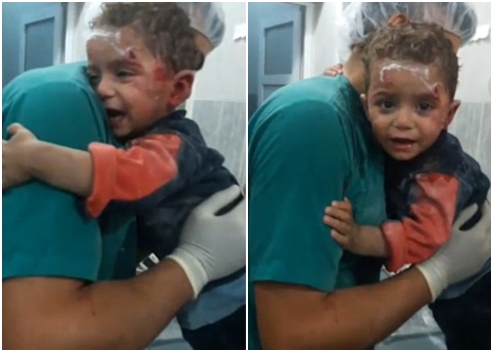 Đau lòng trước hình ảnh cậu bé Syria người đầy máu tuyệt vọng ôm chặt lấy y tá không chịu buông sau trận không kích - Ảnh 2. Đau lòng trước hình ảnh cậu bé Syria người đầy máu tuyệt vọng ôm chặt lấy y tá không chịu buông sau trận không kích - Ảnh 2.