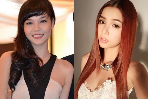 Muốn xinh đẹp, hàng loạt sao nữ châu Á đã tiền mất, tật mang vì lạm dụng thẩm mỹ - Ảnh 18.
