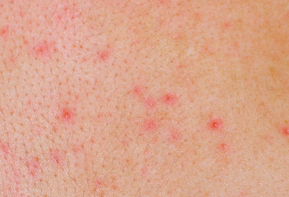 Những dấu hiệu cho thấy bạn đang là nạn nhân của nạn ô nhiễm môi trường - Ảnh 2. Những dấu hiệu cho thấy bạn đang là nạn nhân của nạn ô nhiễm môi trường - Ảnh 2.