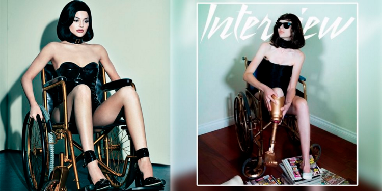 Mất chân, khiếm thính hay bạch tạng đều có thể là người mẫu lừng danh! - Ảnh 10. Mất chân, khiếm thính hay bạch tạng đều có thể là người mẫu lừng danh! - Ảnh 10.