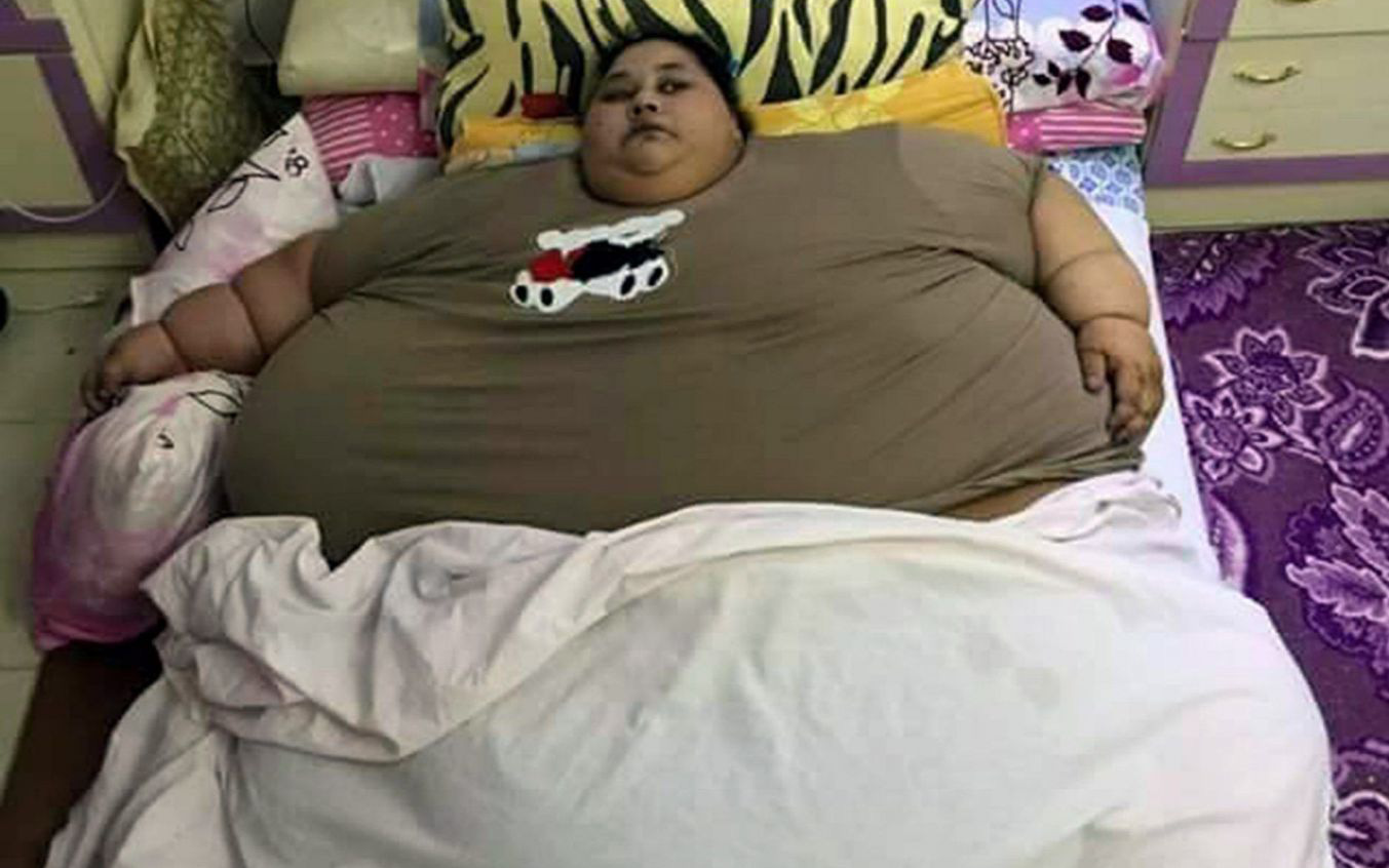 самый толстый в мире фото