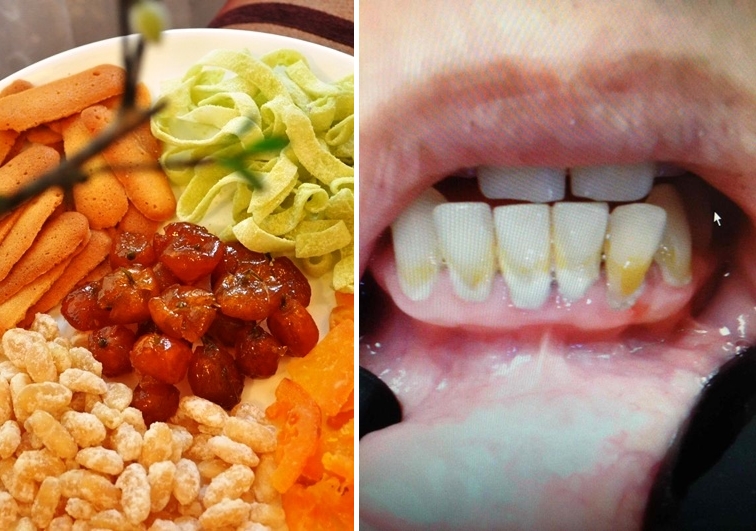 Tết hay ăn đồ chua, ngọt bị đau răng, cứ làm theo mẹo này là khỏi! - Ảnh 1. Tết hay ăn đồ chua, ngọt bị đau răng, cứ làm theo mẹo này là khỏi! - Ảnh 1.