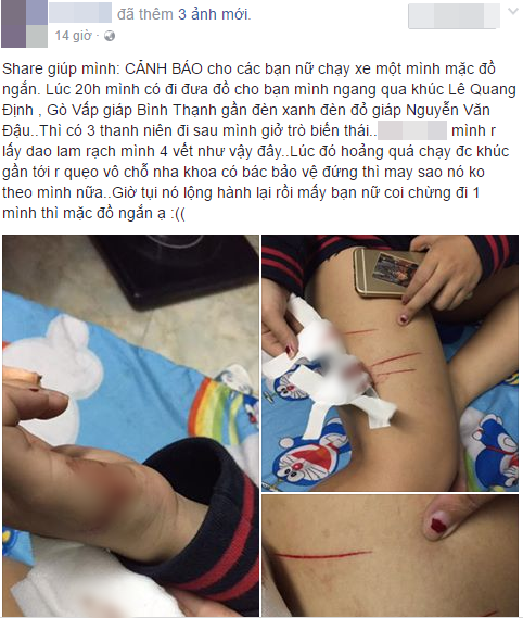 Cô gái trẻ phải điều trị phơi nhiễm HIV khi bị nhóm biến thái rạch đùi trong đêm ở Sài Gòn - Ảnh 1.