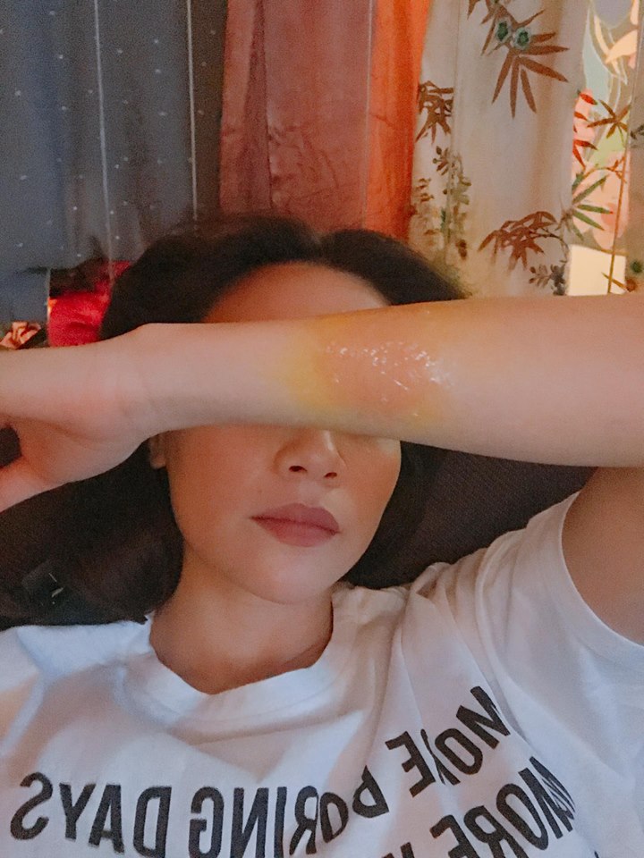 Đằng sau những MV đẹp lung linh là hàng loạt tai nạn trầy da tróc vảy nhớ đời của sao Vpop - Ảnh 7. Đằng sau những MV đẹp lung linh là hàng loạt tai nạn trầy da tróc vảy nhớ đời của sao Vpop - Ảnh 7.