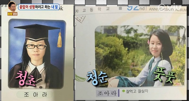 Nữ sinh Hàn Quốc phẫu thuật thẩm mỹ để có nét đẹp đậm chất tây như Kylie Jenner - Ảnh 5. Nữ sinh Hàn Quốc phẫu thuật thẩm mỹ để có nét đẹp đậm chất tây như Kylie Jenner - Ảnh 5.