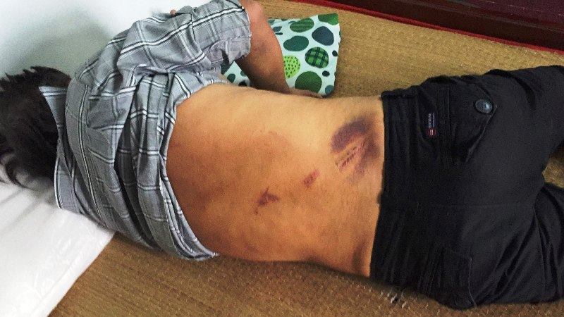 Can đánh nhau, người đàn ông bị nhóm côn đồ truy sát trong hẻm ở Sài Gòn - Ảnh 2. Can đánh nhau, người đàn ông bị nhóm côn đồ truy sát trong hẻm ở Sài Gòn - Ảnh 2.