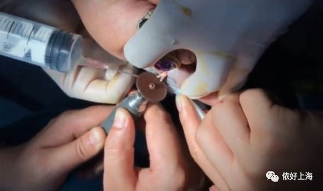 Đeo nhẫn đủ 10 ngón tay, người phụ nữ thích khoe của khóc tu tu gọi đội cứu hộ vì không tháo ra được - Ảnh 5. Đeo nhẫn đủ 10 ngón tay, người phụ nữ thích khoe của khóc tu tu gọi đội cứu hộ vì không tháo ra được 5