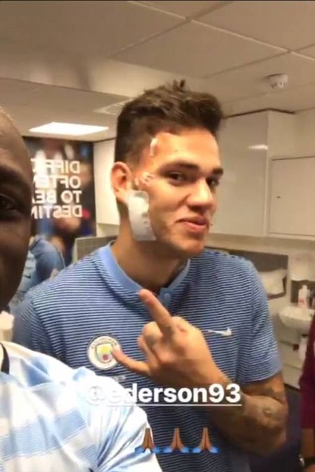 Thủ môn Man City cười tươi, không bị tổn thương não sau va chạm nguy hiểm - Ảnh 2. Thủ môn Man City cười tươi, không bị tổn thương não sau va chạm nguy hiểm - Ảnh 2.