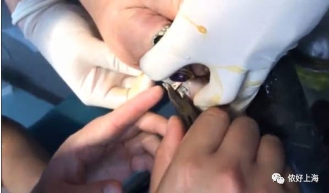 Đeo nhẫn đủ 10 ngón tay, người phụ nữ thích khoe của khóc tu tu gọi đội cứu hộ vì không tháo ra được - Ảnh 6. Đeo nhẫn đủ 10 ngón tay, người phụ nữ thích khoe của khóc tu tu gọi đội cứu hộ vì không tháo ra được 6