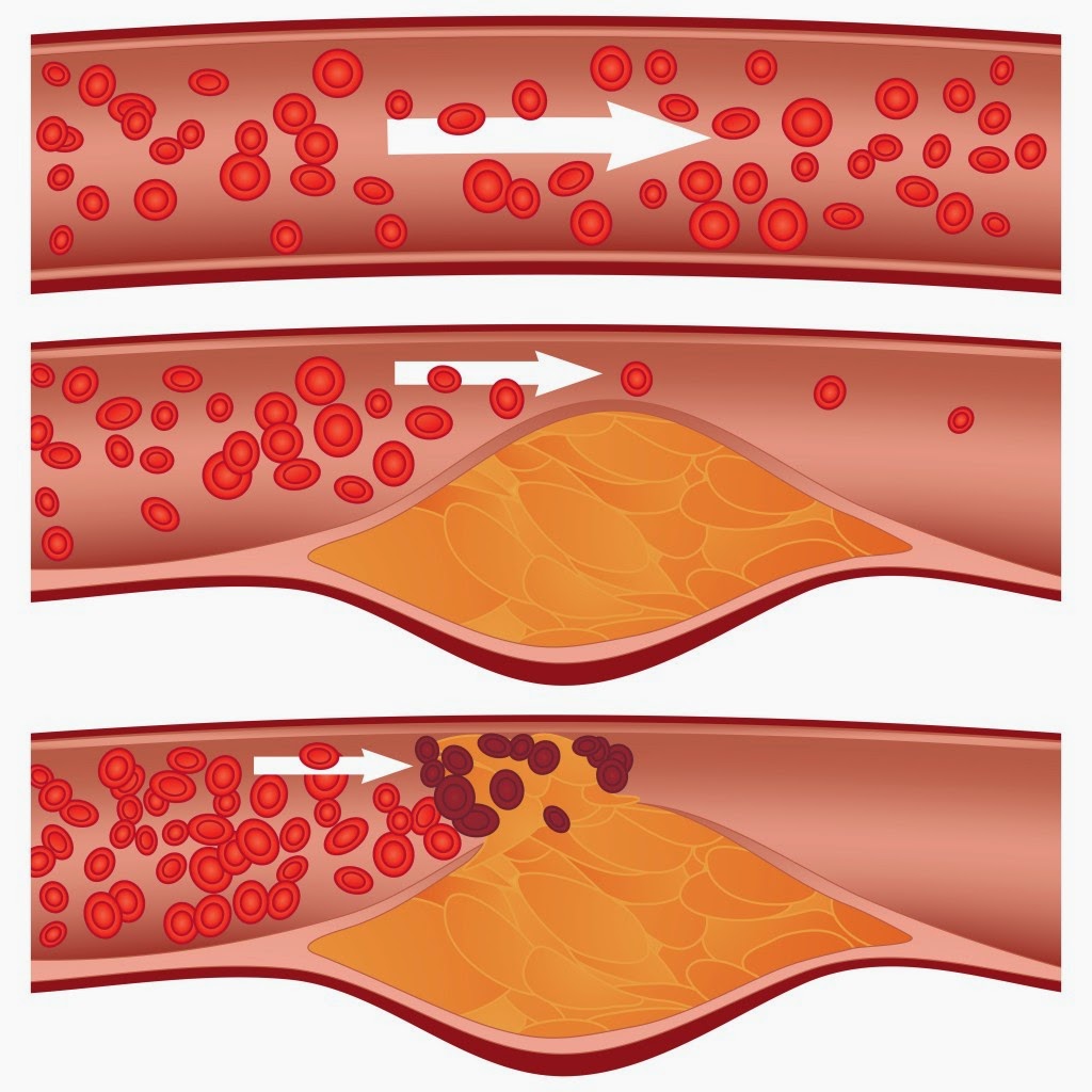 Cẩn thận với các nguy cơ mắc bệnh nghiêm trọng nếu bạn bị béo bụng - Ảnh 2. Cẩn thận với các nguy cơ mắc bệnh nghiêm trọng nếu bạn bị béo bụng - Ảnh 2.