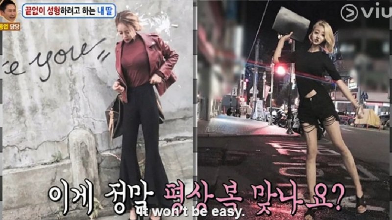 Nữ sinh Hàn Quốc phẫu thuật thẩm mỹ để có nét đẹp đậm chất tây như Kylie Jenner - Ảnh 6. Nữ sinh Hàn Quốc phẫu thuật thẩm mỹ để có nét đẹp đậm chất tây như Kylie Jenner - Ảnh 6.