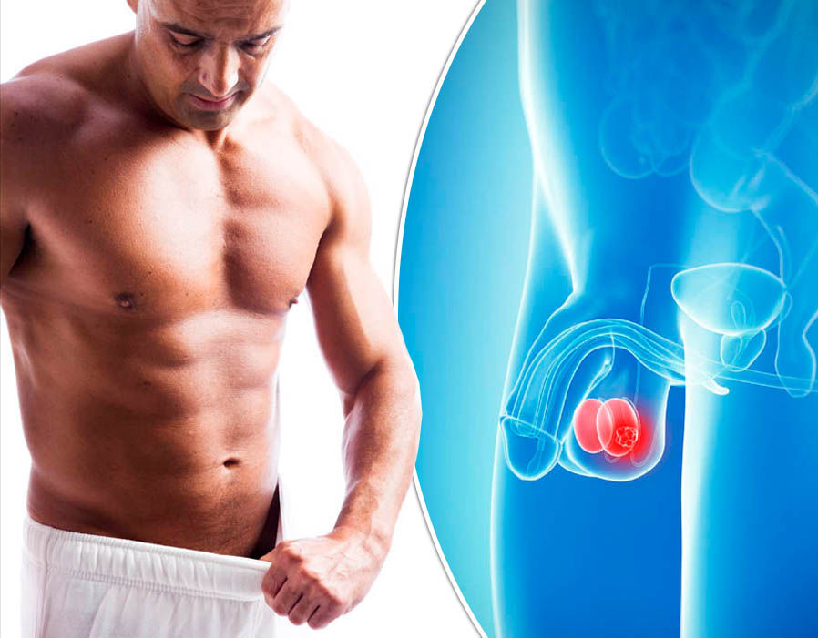 Dựa vào nhóm gen di truyền có thể chẩn đoán được căn bệnh ung thư phổ biến ở nam giới - Ảnh 2. Dựa vào nhóm gen di truyền có thể chẩn đoán được căn bệnh ung thư phổ biến ở nam giới - Ảnh 2.