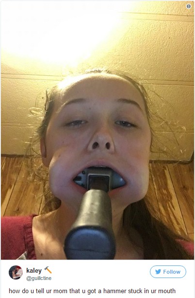 Một fan hâm mộ phải nhập viện sau khi tự nhét cả cây búa vào miệng để thể hiện tình yêu dành cho các chàng trai BTS - Ảnh 2. Một fan hâm mộ phải nhập viện sau khi tự nhét cả cây búa vào miệng để thể hiện tình yêu dành cho các chàng trai BTS - Ảnh 2.