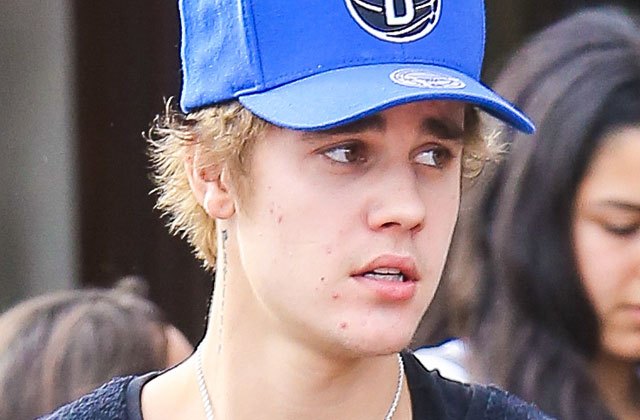 justin-bieber-popping-pimples-1493460345