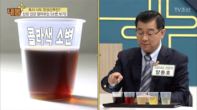 Bác sĩ Hàn Quốc hướng dẫn cách nhìn tình trạng nước tiểu xác định xem cơ thể đang mắc bệnh gì - Ảnh 3.