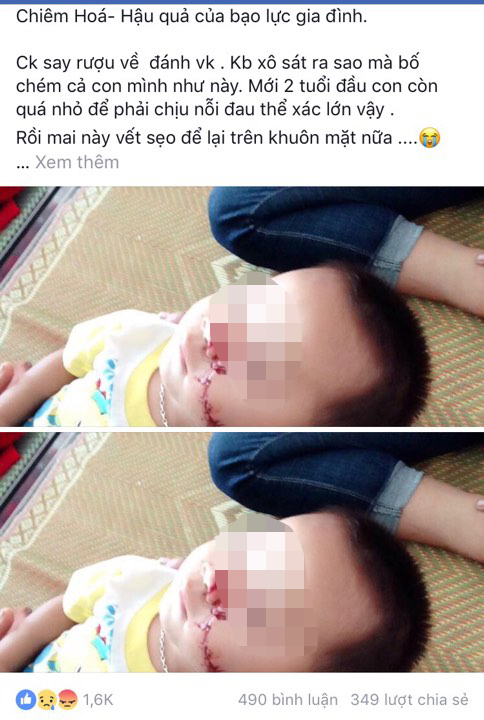 Sự thật câu chuyện bố chém con trai 2 tuổi rách mặt ở Tuyên Quang - Ảnh 2. Sự thật câu chuyện bố chém con trai 2 tuổi rách mặt ở Tuyên Quang 2