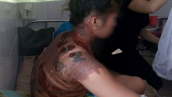 Bắt giam người chồng đòi lại quà cưới, tưới nước sôi lên vợ - Ảnh 1. Bắt giam người chồng đòi lại quà cưới, tưới nước sôi lên vợ - Ảnh 1.