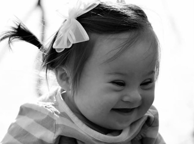 Lá thư người mẹ có con gái bị Down gửi vị bác sĩ từng khuyên cô phá thai khiến nhiều người suy ngẫm - Ảnh 1. Lá thư người mẹ có con gái bị Down gửi vị bác sĩ từng khuyên cô phá thai khiến nhiều người suy ngẫm - Ảnh 1.