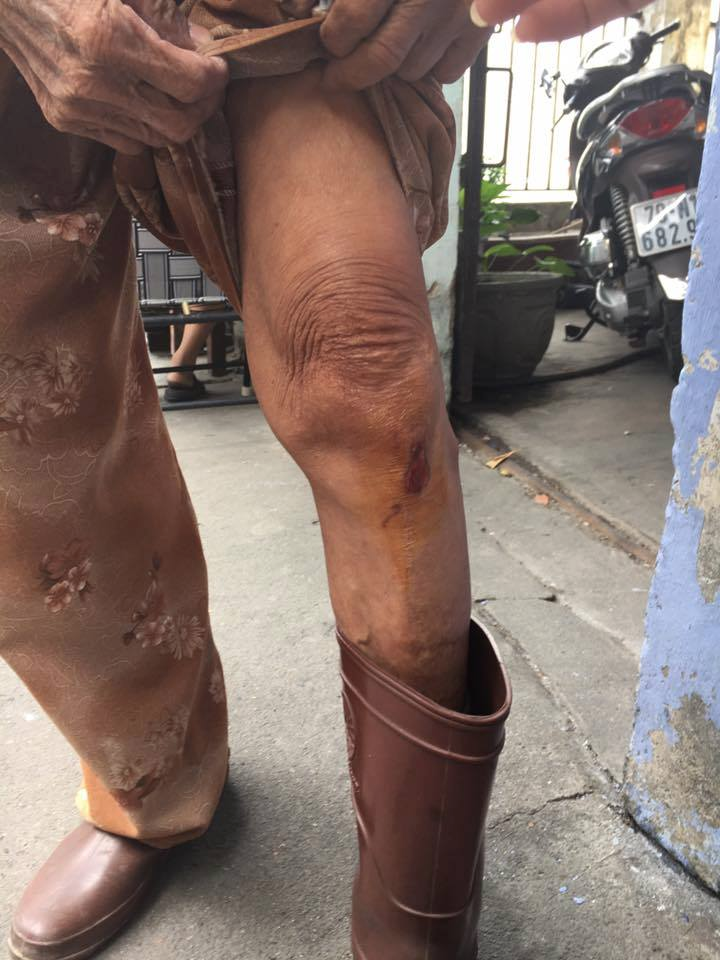 Cụ bà 80 tuổi bị nam thanh niên giật 560 tờ vé số và 400 nghìn đồng - Ảnh 2. Cụ bà 80 tuổi bị nam thanh niên giật 560 tờ vé số và 400 nghìn đồng - Ảnh 2.