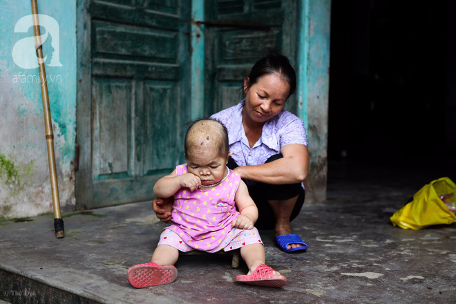 Cô gái gần 30 vẫn mang hình hài của đứa trẻ 2 tuổi: Lủi thủi trong nhà cả đời, không có bạn cùng chơi - Ảnh 2. Cô gái gần 30 vẫn mang hình hài của đứa trẻ 2 tuổi: Lủi thủi trong nhà cả đời, không có bạn cùng chơi - Ảnh 2.