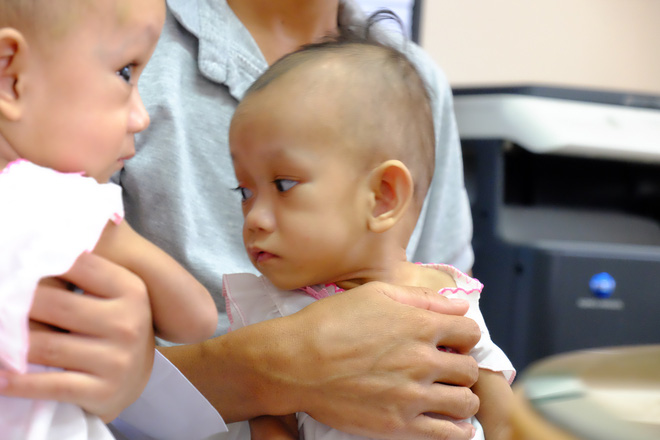 Ngắm vẻ đáng yêu của hai bé gái sinh đôi dính nhau vùng cùng cụt ngày xuất viện - Ảnh 2. Ngắm vẻ đáng yêu của hai bé gái sinh đôi dính nhau vùng cùng cụt ngày xuất viện - Ảnh 2.