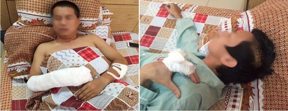 Quảng Ninh: Điều tra 2 côn đồ chém trọng thương khách tại quán ăn đêm - Ảnh 2. Quảng Ninh: Điều tra 2 côn đồ chém trọng thương khách tại quán ăn đêm - Ảnh 2.