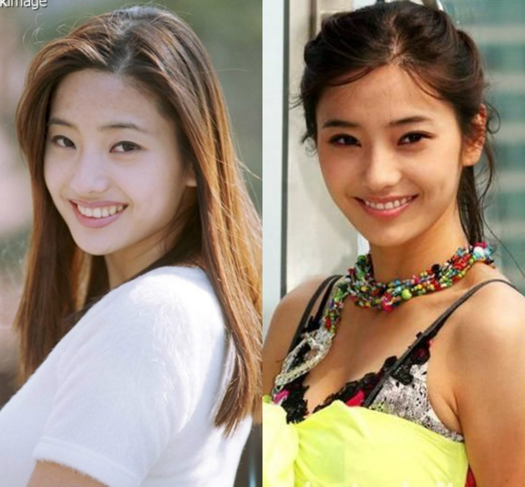 Khác biệt nhan sắc của dàn mỹ nhân dao kéo Kbiz: Thẩm mỹ ít xinh đẹp rạng rỡ, lạm dụng nhiều xuống sắc không phanh - Ảnh 1. Khác biệt nhan sắc của dàn mỹ nhân dao kéo Kbiz: Thẩm mỹ ít xinh đẹp rạng rỡ, lạm dụng nhiều xuống sắc không phanh - Ảnh 1.