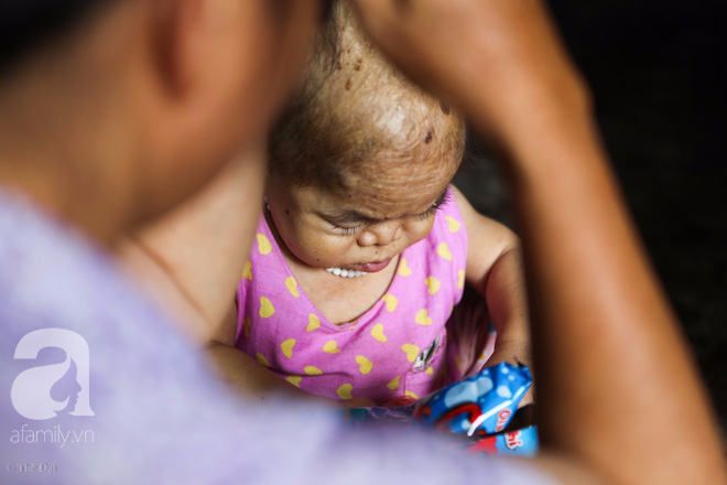 Cô gái gần 30 vẫn mang hình hài của đứa trẻ 2 tuổi: Lủi thủi trong nhà cả đời, không có bạn cùng chơi - Ảnh 11. Cô gái gần 30 vẫn mang hình hài của đứa trẻ 2 tuổi: Lủi thủi trong nhà cả đời, không có bạn cùng chơi - Ảnh 11.