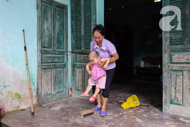 Cô gái gần 30 vẫn mang hình hài của đứa trẻ 2 tuổi: Lủi thủi trong nhà cả đời, không có bạn cùng chơi - Ảnh 13. Cô gái gần 30 vẫn mang hình hài của đứa trẻ 2 tuổi: Lủi thủi trong nhà cả đời, không có bạn cùng chơi - Ảnh 13.