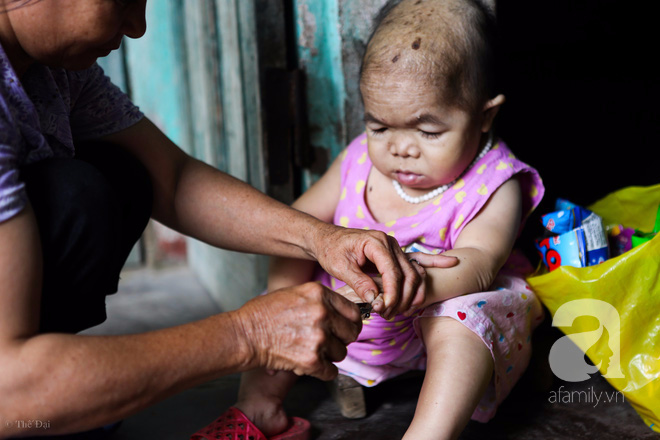 Cô gái gần 30 vẫn mang hình hài của đứa trẻ 2 tuổi: Lủi thủi trong nhà cả đời, không có bạn cùng chơi - Ảnh 14. Cô gái gần 30 vẫn mang hình hài của đứa trẻ 2 tuổi: Lủi thủi trong nhà cả đời, không có bạn cùng chơi - Ảnh 14.