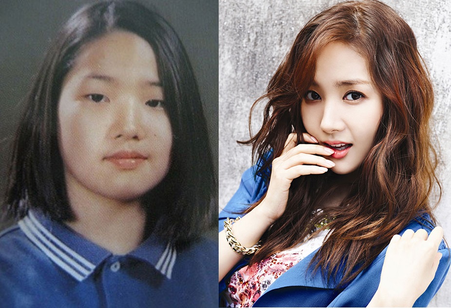 Khác biệt nhan sắc của dàn mỹ nhân dao kéo Kbiz: Thẩm mỹ ít xinh đẹp rạng rỡ, lạm dụng nhiều xuống sắc không phanh - Ảnh 14. Khác biệt nhan sắc của dàn mỹ nhân dao kéo Kbiz: Thẩm mỹ ít xinh đẹp rạng rỡ, lạm dụng nhiều xuống sắc không phanh - Ảnh 14.
