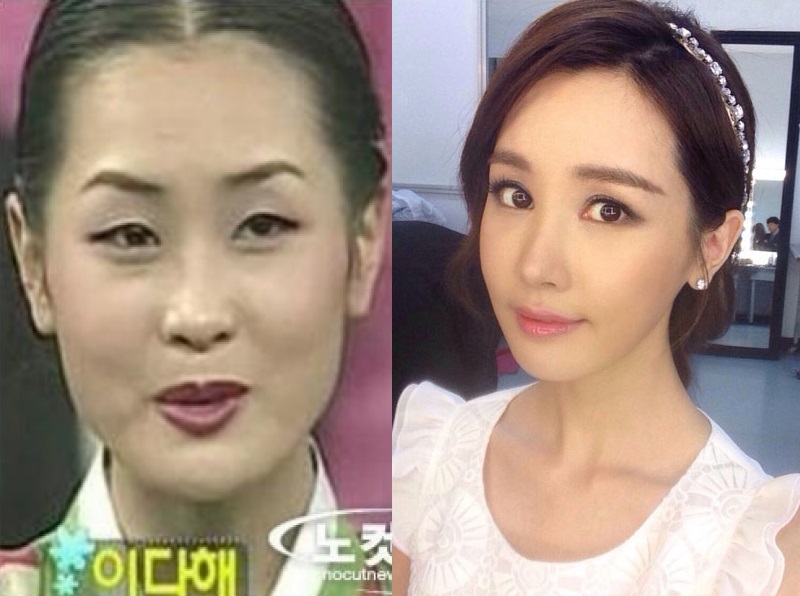 Khác biệt nhan sắc của dàn mỹ nhân dao kéo Kbiz: Thẩm mỹ ít xinh đẹp rạng rỡ, lạm dụng nhiều xuống sắc không phanh - Ảnh 18. Khác biệt nhan sắc của dàn mỹ nhân dao kéo Kbiz: Thẩm mỹ ít xinh đẹp rạng rỡ, lạm dụng nhiều xuống sắc không phanh - Ảnh 18.