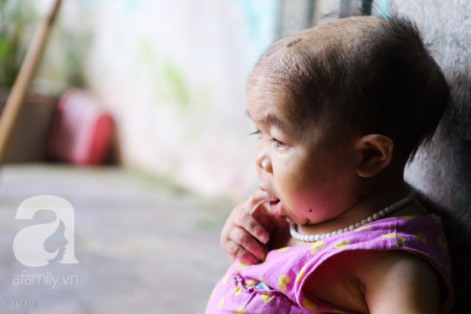 Cô gái gần 30 vẫn mang hình hài của đứa trẻ 2 tuổi: Lủi thủi trong nhà cả đời, không có bạn cùng chơi - Ảnh 19. Cô gái gần 30 vẫn mang hình hài của đứa trẻ 2 tuổi: Lủi thủi trong nhà cả đời, không có bạn cùng chơi - Ảnh 19.