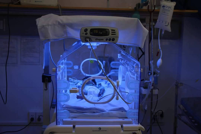 TP.HCM: Cứu sống bé sơ sinh chỉ nặng 1,3kg trong tình trạng suy hô hấp nặng - Ảnh 3. TP.HCM: Cứu sống bé sơ sinh chỉ nặng 1,3kg trong tình trạng suy hô hấp nặng - Ảnh 3.