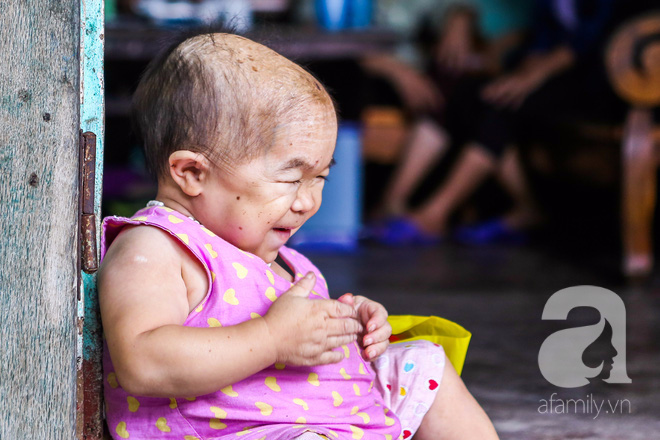 Cô gái gần 30 vẫn mang hình hài của đứa trẻ 2 tuổi: Lủi thủi trong nhà cả đời, không có bạn cùng chơi - Ảnh 21. Cô gái gần 30 vẫn mang hình hài của đứa trẻ 2 tuổi: Lủi thủi trong nhà cả đời, không có bạn cùng chơi - Ảnh 21.