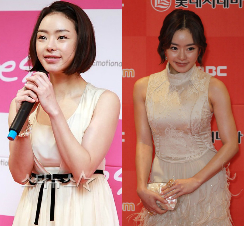 Khác biệt nhan sắc của dàn mỹ nhân dao kéo Kbiz: Thẩm mỹ ít xinh đẹp rạng rỡ, lạm dụng nhiều xuống sắc không phanh - Ảnh 23. Khác biệt nhan sắc của dàn mỹ nhân dao kéo Kbiz: Thẩm mỹ ít xinh đẹp rạng rỡ, lạm dụng nhiều xuống sắc không phanh - Ảnh 23.