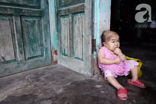 Cô gái gần 30 vẫn mang hình hài của đứa trẻ 2 tuổi: Lủi thủi trong nhà cả đời, không có bạn cùng chơi - Ảnh 6. Cô gái gần 30 vẫn mang hình hài của đứa trẻ 2 tuổi: Lủi thủi trong nhà cả đời, không có bạn cùng chơi - Ảnh 6.