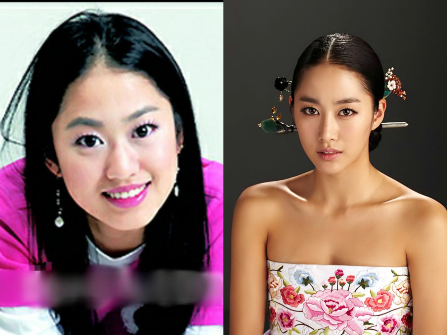 Khác biệt nhan sắc của dàn mỹ nhân dao kéo Kbiz: Thẩm mỹ ít xinh đẹp rạng rỡ, lạm dụng nhiều xuống sắc không phanh - Ảnh 6. Khác biệt nhan sắc của dàn mỹ nhân dao kéo Kbiz: Thẩm mỹ ít xinh đẹp rạng rỡ, lạm dụng nhiều xuống sắc không phanh - Ảnh 6.