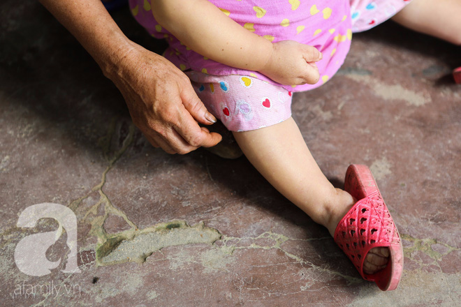 Cô gái gần 30 vẫn mang hình hài của đứa trẻ 2 tuổi: Lủi thủi trong nhà cả đời, không có bạn cùng chơi - Ảnh 7. Cô gái gần 30 vẫn mang hình hài của đứa trẻ 2 tuổi: Lủi thủi trong nhà cả đời, không có bạn cùng chơi - Ảnh 7.