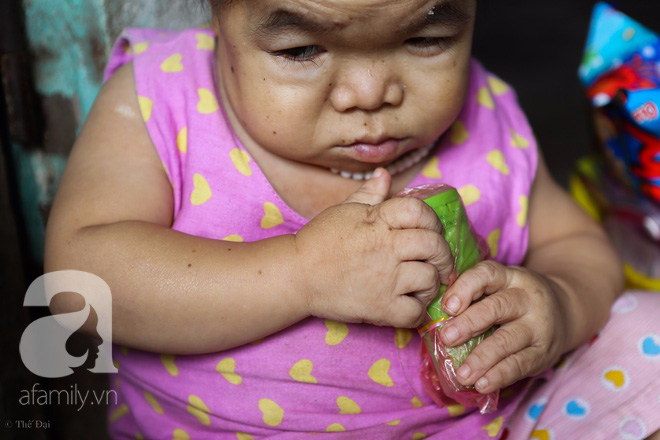 Cô gái gần 30 vẫn mang hình hài của đứa trẻ 2 tuổi: Lủi thủi trong nhà cả đời, không có bạn cùng chơi - Ảnh 8. Cô gái gần 30 vẫn mang hình hài của đứa trẻ 2 tuổi: Lủi thủi trong nhà cả đời, không có bạn cùng chơi - Ảnh 8.