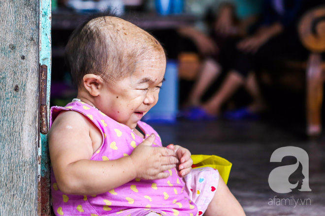 Cô gái gần 30 vẫn mang hình hài của đứa trẻ 2 tuổi: Lủi thủi trong nhà cả đời, không có bạn cùng chơi - Ảnh 9. Cô gái gần 30 vẫn mang hình hài của đứa trẻ 2 tuổi: Lủi thủi trong nhà cả đời, không có bạn cùng chơi - Ảnh 9.