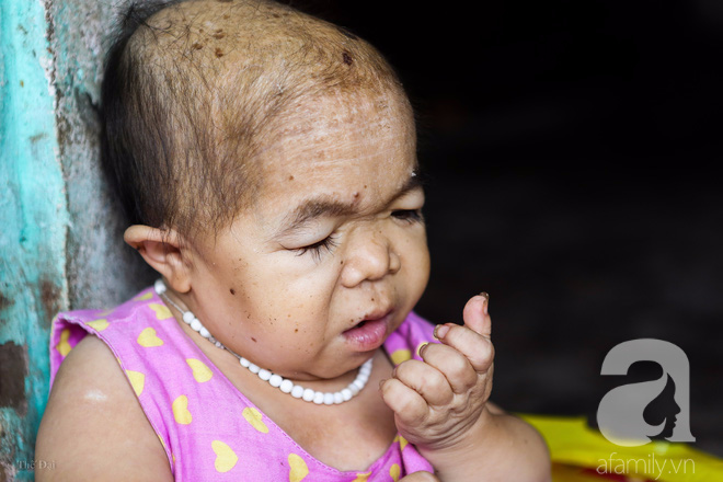 Cô gái gần 30 vẫn mang hình hài của đứa trẻ 2 tuổi: Lủi thủi trong nhà cả đời, không có bạn cùng chơi - Ảnh 10. Cô gái gần 30 vẫn mang hình hài của đứa trẻ 2 tuổi: Lủi thủi trong nhà cả đời, không có bạn cùng chơi - Ảnh 10.