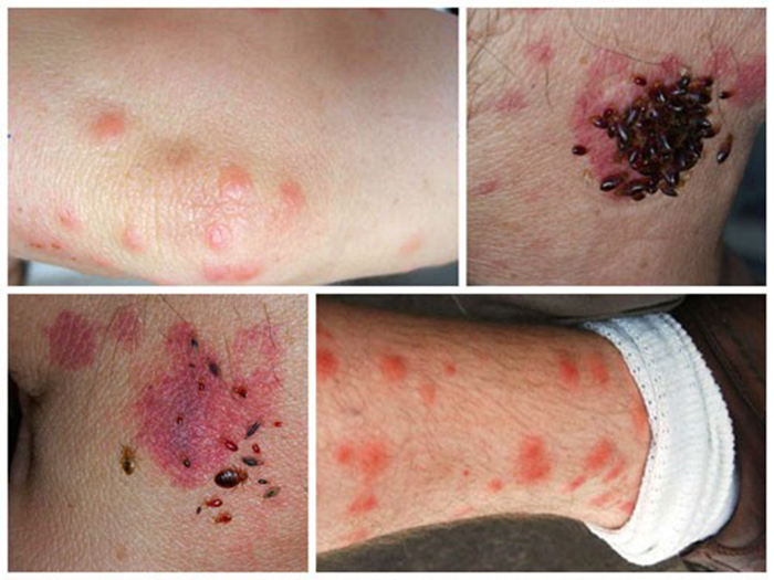 Vứt quần áo bẩn lên giường và cái kết khiến bạn không bao giờ dám làm vậy nữa - Ảnh 1. Vứt quần áo bẩn lên giường và cái kết khiến bạn không bao giờ dám làm vậy nữa - Ảnh 1.