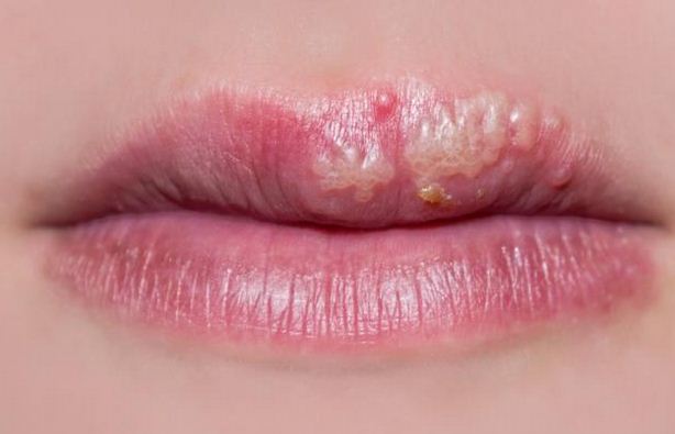 Nữ giới vẫn thường xuyên làm điều này mà không biết tác hại kinh khủng của nó - Ảnh 3. Nữ giới vẫn thường xuyên làm điều này mà không biết tác hại kinh khủng của nó - Ảnh 3.